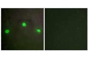 Immunofluorescence analysis of A549 cells, using ATRX antibody. (ATRX 抗体  (N-Term))