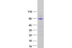 Western Blotting (WB) image for Far Upstream Element (FUSE) Binding Protein 3 (FUBP3) protein (Myc-DYKDDDDK Tag) (ABIN2721444)