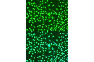 Immunofluorescence analysis of U2OS cells using CCNA2 antibody. (Cyclin A 抗体)