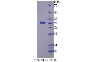 SDS-PAGE analysis of Mouse FADD Protein. (FADD 蛋白)