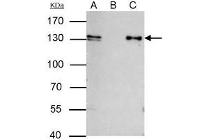 IP Image MCM2 antibody [N1N2], N-term immunoprecipitates MCM2 protein in IP experiments. (MCM2 抗体  (N-Term))