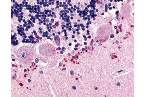 Immunohistochemistry on human brain sections (Purkinje cell layer) using CELSR3 antibody ABIN122031. (CELSR3 抗体  (N-Term))
