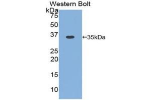 Western blot analysis of the recombinant protein. (Cyclin D1 抗体  (AA 1-292))