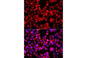 Immunofluorescence analysis of A549 cell using EIF4G1 antibody. (EIF4G1 抗体)