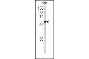 Western blot analysis of GALNT2 Antibody (N-term) in Hela cell line lysates (35ug/lane). (GALNT2 抗体  (N-Term))