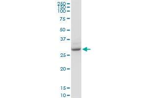 YWHAZ monoclonal antibody (M04), clone 1B3. (14-3-3 zeta 抗体  (AA 51-150))