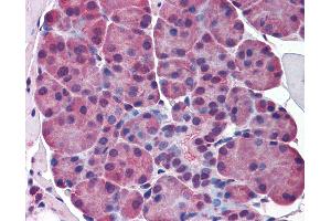 Immunohistochemistry (IHC) image for anti-E74-Like Factor 5 (Ets Domain Transcription Factor) (ELF5) (AA 101-150) antibody (ABIN768772)