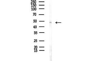 Western blot analysis of lysates from F10-LUC cells(UV,30 min treatment), using Wnt10b Antibody at 1/1000 dilution.