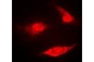 Immunofluorescence (IF) image for anti-Proteasome (Prosome, Macropain) Subunit, beta Type 2 (PSMB2) antibody (ABIN7306308)