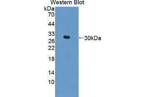 Detection of Recombinant IkBd, Mouse using Polyclonal Antibody to Inhibitory Subunit Of NF Kappa B Delta (IkBd) (IkBd 抗体  (AA 58-304))