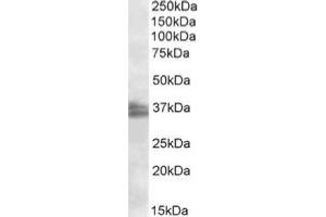 AP20113PU-N FRG1 antibody staining of Jurkat nuclear lysate at 2 µg/ml (RIPA buffer, 35 µg total protein per lane). (FRG1 抗体  (Internal Region))