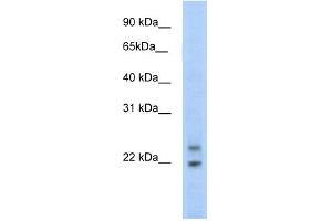 WB Suggested Anti-C330003B14RIK Antibody Titration:  5. (CPHX 抗体  (N-Term))