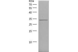 Western Blotting (WB) image for Cyclin-Dependent Kinase 4 (CDK4) (AA 207-303) protein (His-IF2DI Tag) (ABIN7122532) (CDK4 Protein (AA 207-303) (His-IF2DI Tag))