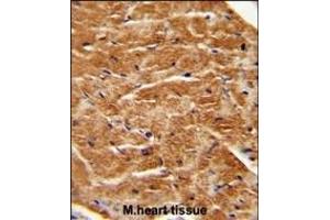 FGF7 antibody (Center) (ABIN654152 and ABIN2844021) immunohistochemistry analysis in formalin fixed and paraffin embedded human M. (FGF7 抗体  (AA 57-86))