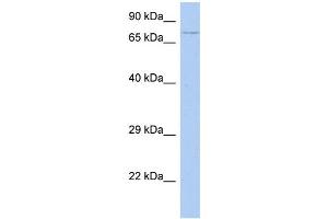 WB Suggested Anti-HEXDC Antibody Titration: 0. (HEXDC 抗体  (Middle Region))