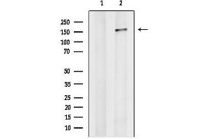 anti-Phosphatidylinositol-3,4,5-Trisphosphate-Dependent Rac Exchange Factor 1 (PREX1) (Internal Region) antibody