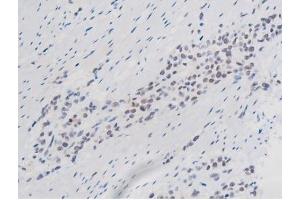 Immunohistochemistry (IHC) image for anti-Signal Transducer and Activator of Transcription 1, 91kDa (STAT1) (pSer727) antibody (ABIN6256410)