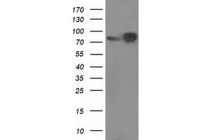 Western Blotting (WB) image for anti-Catenin (Cadherin-Associated Protein), beta 1, 88kDa (CTNNB1) antibody (ABIN1496893) (CTNNB1 抗体)