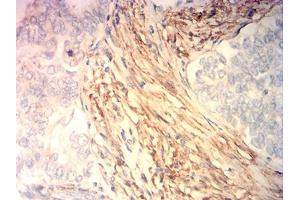 Immunohistochemistry (IHC) image for anti-Calponin 3, Acidic (CNN3) (AA 26-130) antibody (ABIN7193498)