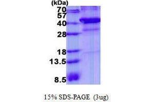 Figure annotation denotes ug of protein loaded and % gel used. (XRCC3 蛋白)