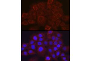 Immunofluorescence (IF) image for anti-serpin Peptidase Inhibitor, Clade B (Ovalbumin), Member 3 (SERPINB3) (AA 1-230) antibody (ABIN6147587)