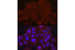 Immunofluorescence analysis of  cells using SSC/SerpinB3 Rabbit pAb (ABIN6131348, ABIN6147587, ABIN6147588 and ABIN6221070) at dilution of 1:100 (40x lens). (SERPINB3 抗体  (AA 1-230))