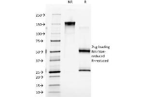 SDS-PAGE Analysis Purified Macrophage Monoclonal Antibody (D11). (Macrophage / Histiocytoma Marker 抗体)