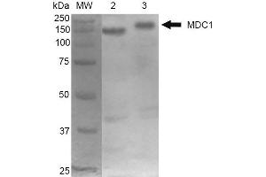 Western Blot analysis of Mouse Cortex and Cerebellum showing detection of 184 kDa MDC1 protein using Mouse Anti-MDC1 Monoclonal Antibody, Clone P2B11 . (MDC1 抗体  (N-Term) (Biotin))