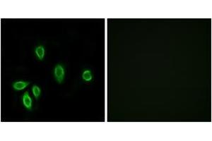 Immunofluorescence analysis of A549 cells, using TRHR Antibody. (TRHR 抗体  (AA 195-244))