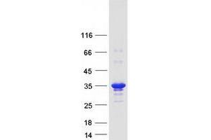 Western Blotting (WB) image for Potassium Channel Tetramerisation Domain Containing 15 (KCTD15) (Transcript Variant 1) protein (Myc-DYKDDDDK Tag) (ABIN2724070)