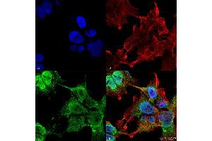 Immunofluorescence (fixed cells) (IF/ICC) image for anti-Voltage-Dependent Anion Channel 1 (VDAC1) (AA 1-283) antibody (HRP) (ABIN1741228)