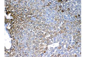 IHC analysis of IGFBP1 using anti-IGFBP1 antibody .