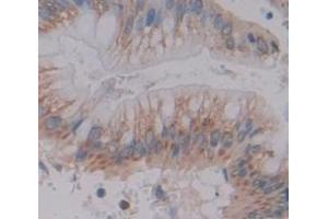Used in DAB staining on fromalin fixed paraffin- embedded Kidney tissue (MUC3B 抗体  (AA 836-931))