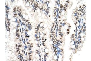 RUNDC2A antibody was used for immunohistochemistry at a concentration of 4-8 ug/ml to stain Epithelial cells of intestinal villus (arrows) in Human Intestine. (SNX29 抗体  (N-Term))