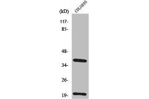 Western Blot analysis of COLO205 cells using TCR β Polyclonal Antibody (TRBC1 抗体  (Internal Region))