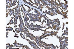 IHC analysis of TRMT61B using anti-TRMT61B antibody (ABIN7602334). (TRMT61B 抗体  (AA 7-477))