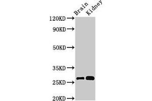 Western Blot Positive WB detected in: Mouse brain tissue, Mouse kidney tissue All lanes: OLFML2B antibody at 3 μg/mL Secondary Goat polyclonal to rabbit IgG at 1/50000 dilution Predicted band size: 84, 28 kDa Observed band size: 28 kDa (OLFML2B 抗体  (AA 451-750))