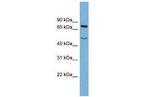 STIM1 antibody used at 1 ug/ml to detect target protein. (STIM1 抗体  (Middle Region))