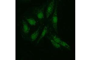 IF analysis of KI/VIRMA using anti-KI/VIRMA antibody (ABIN7599707). (Protein Virilizer Homolog (VIRMA) (AA 11-1529) 抗体)