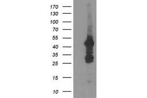 HEK293T cells were transfected with the pCMV6-ENTRY control (Left lane) or pCMV6-ENTRY DOK2 (Right lane) cDNA for 48 hrs and lysed. (DOK2 抗体)