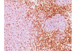 Formalin-fixed, paraffin-embedded human Tonsil (10X) stained with CD6 Monoclonal Antibody (3F7B5). (CD6 抗体)
