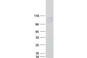 Western Blotting (WB) image for N-Acetylated alpha-Linked Acidic Dipeptidase 2 (NAALAD2) protein (Myc-DYKDDDDK Tag) (ABIN2726750)