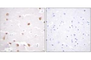 Immunohistochemistry analysis of paraffin-embedded human brain tissue, using CKII-beta (Ab-209) Antibody. (CSNK2B 抗体  (AA 166-215))