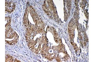 Immunohistochemistry (IHC) image for anti-DNA (Cytosine-5)-Methyltransferase 1 (DNMT1) (AA 22-126) antibody (ABIN5693103)