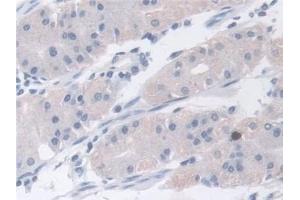 Immunohistochemistry (IHC) image for anti-Actin Related Protein 2/3 Complex, Subunit 2, 34kDa (ARPC2) (AA 1-300) antibody (ABIN7441580)