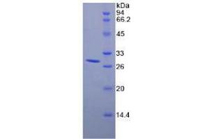 SDS-PAGE analysis of Mouse RIG1 Protein. (DDX58 蛋白)