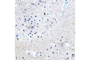 Immunohistochemistry of paraffin-embedded rat brain using Phospho-Tau-S396 Rabbit mAb (ABIN7268523) at dilution of 1:100 (40x lens). (MAPT 抗体  (pSer396))