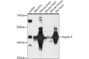 Western blot analysis of extracts of various cell lines, using Septin 5 antibody (ABIN6128759, ABIN6147556, ABIN6147557 and ABIN6216776) at 1:3000 dilution. (Septin 5 抗体  (AA 1-369))