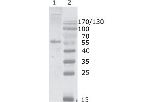 Western Blot testing of HIV-1 Gag p17/24 using HIV-1 p24 antibody, clone 2N32 (05-009). (HIV-1 p24 抗体  (AA 80-90))