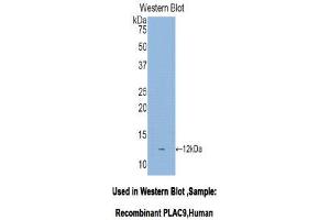 Western Blotting (WB) image for anti-Placenta-Specific 9 (PLAC9) (AA 23-97) antibody (ABIN1078445) (PLAC9 抗体  (AA 23-97))